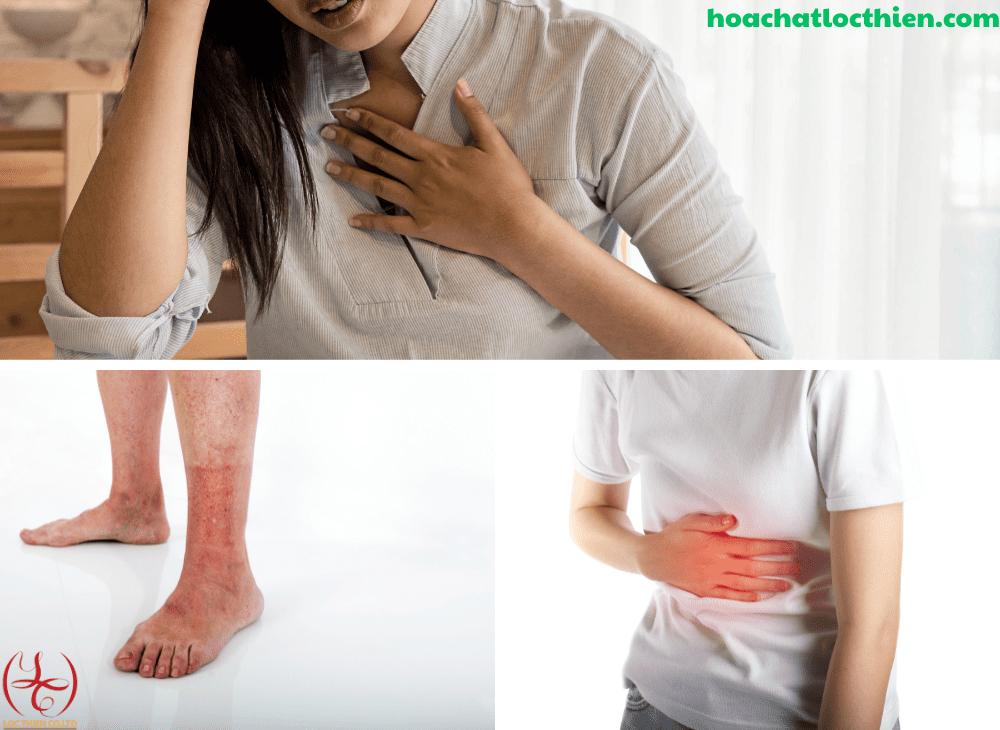 Axit H2SO4, biện pháp xử lí với các sự cố