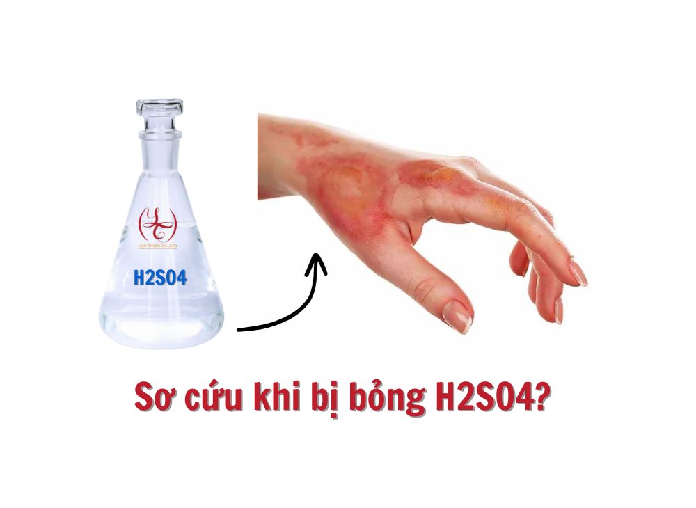 H2SO4; acid H2SO4; acid Sulfuric;